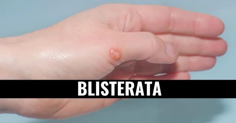 Blisterata: An In-depth Exploration